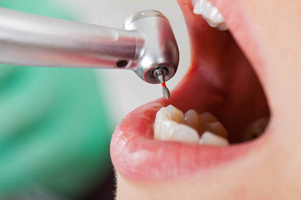 Best Emergency Dental Extractions in Pleasureville, PA